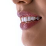 127 Proteza na implantach: jak przebiega proces i czego można się spodziewać