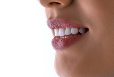 127 Proteza na implantach: jak przebiega proces i czego można się spodziewać
